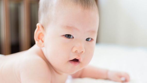 A baby with plagiocephaly.